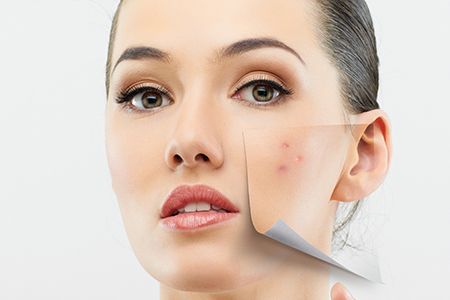 ВЕСЕННЯЯ АТМОСФЕРА: ВСЁ О ПИЛИНГЕ